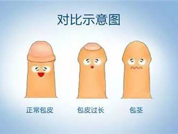 芜湖
男科哪里治疗比较好-芜湖
看男科那个医院正规?